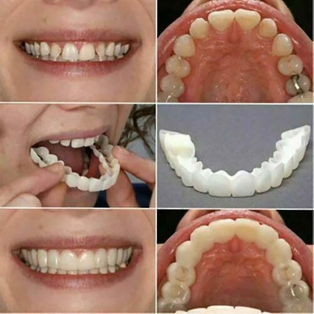 Smile Snap On False Teeth Facettes dentaires inférieures et supérieures Prothèses dentaires Ensemble de couverture dentaire
