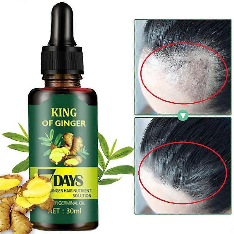 2pcs Hair Growth Spray 30ml