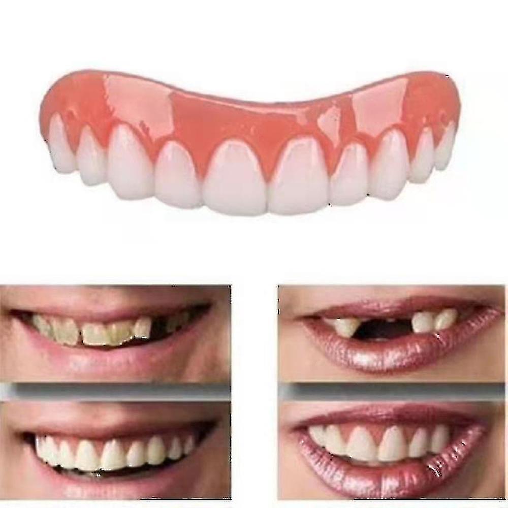 2 Sets Of Dentures, Upper And Lower Jaw Dentures, Natural And Comfortable, Protect The Teeth, And Regain A Confident Smile