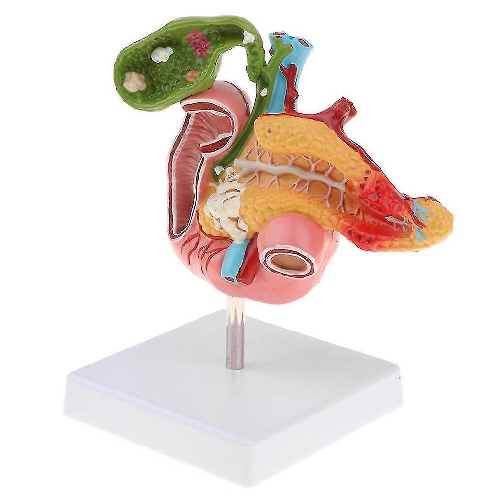 1:1 Life Size Human Pancreas Duodenum Gallbladder Pathology Model, Lab Office Decor