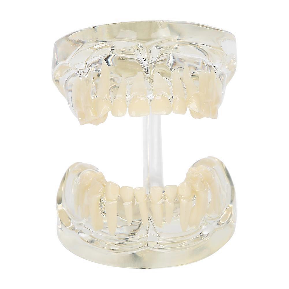 Dental Deciduous Teeth Model Removable Teeth Model Teaching Tool for Dentist