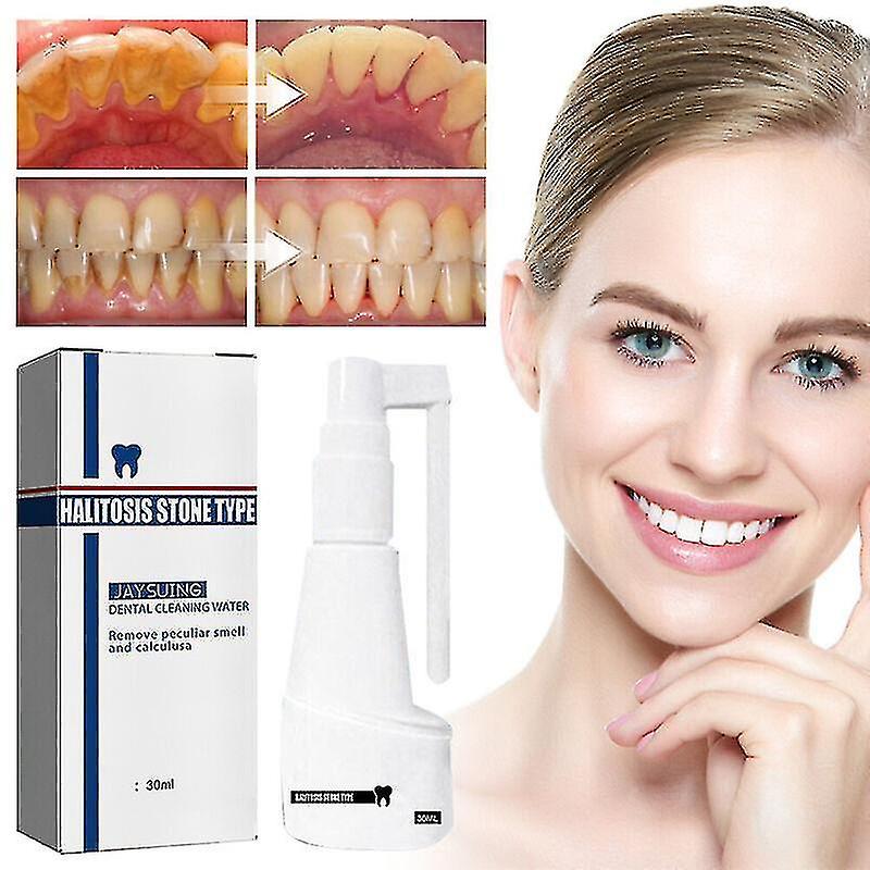 30ml Calculus Dissolving Dental Spray Oral Tooth Cleaner Tartar Remover