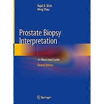 Prostate Biopsy Interpretation An Illustrated Guide