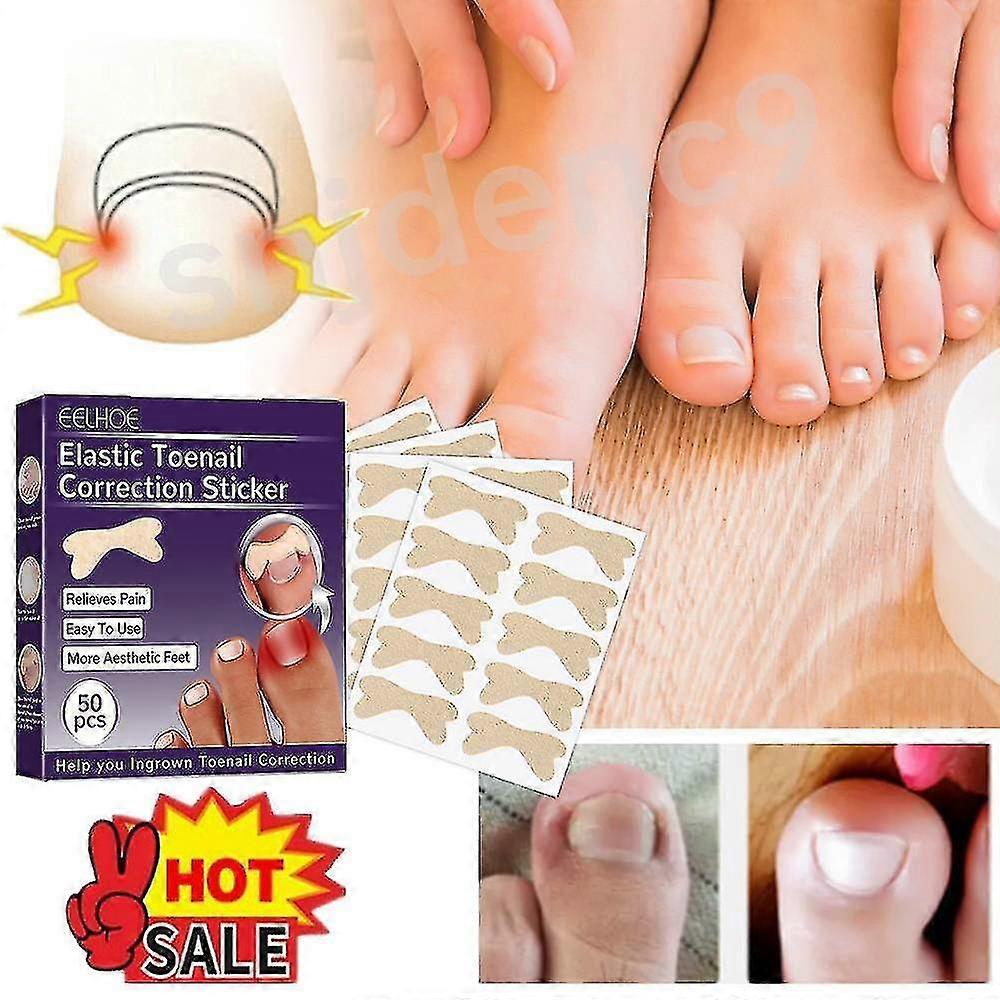 Fertoe Toenail Corrector Pedicure Patch Ingrown Toe Nail Correction Sticker 50pcs/box
