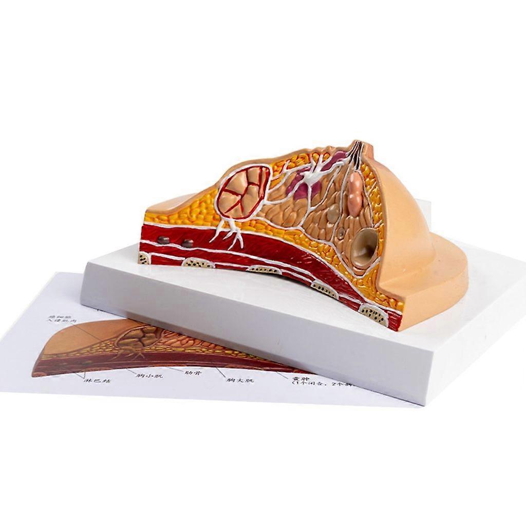 Anatomical Pathological Breast Model for Study Medical Lecture, Life Size