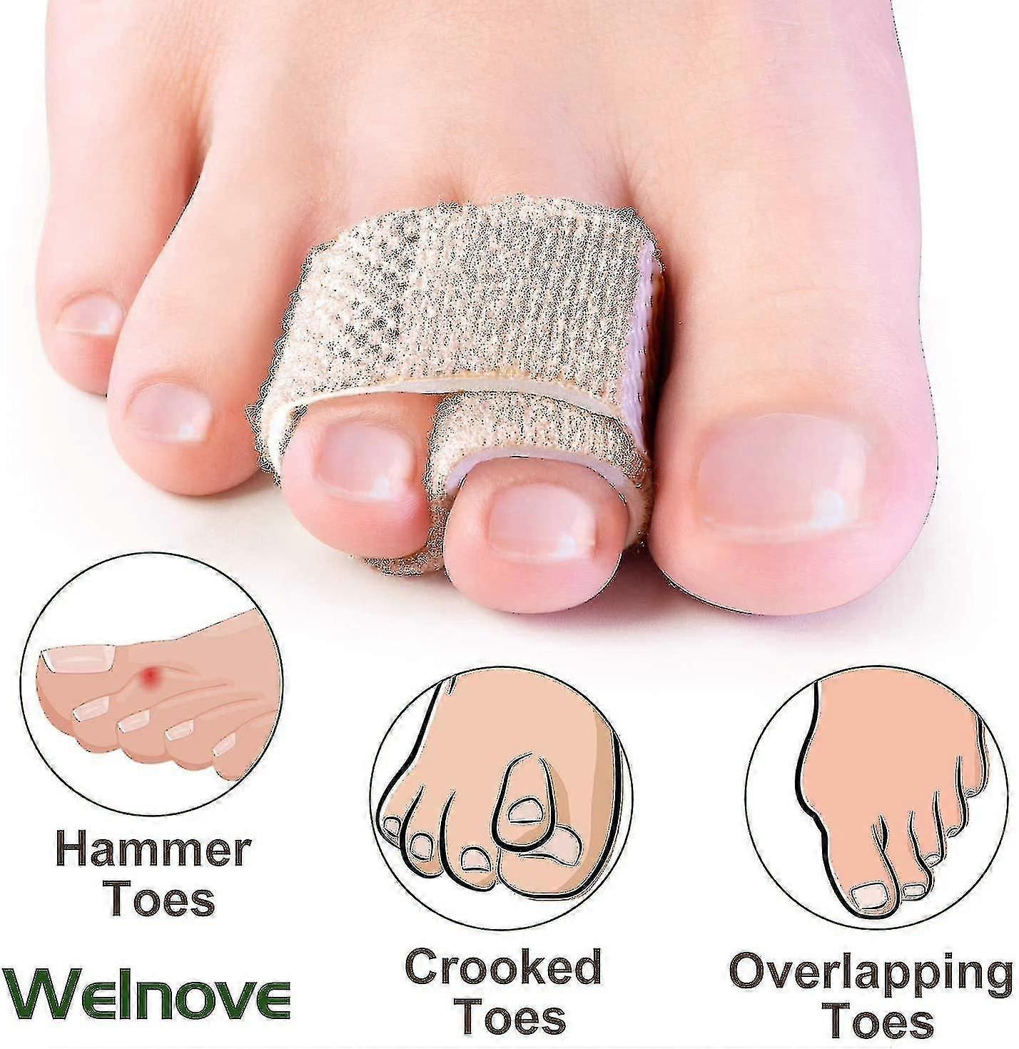 6-pcs Of Hammer Toe Straighteners For Straightening Hammer Toes, Broken Toes, Crooked Toes And Overlapping Toes