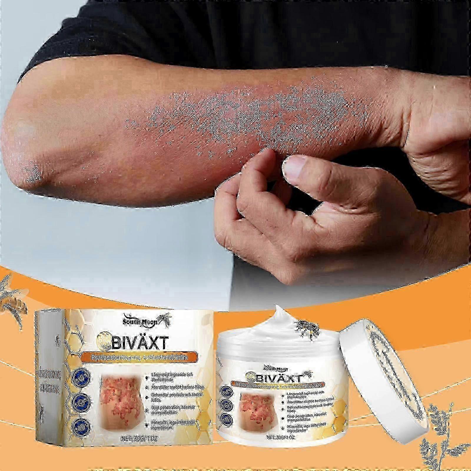 Bees-venom Psoriasises Cream Anti-itch Skin Relief Cream Skin Care Products