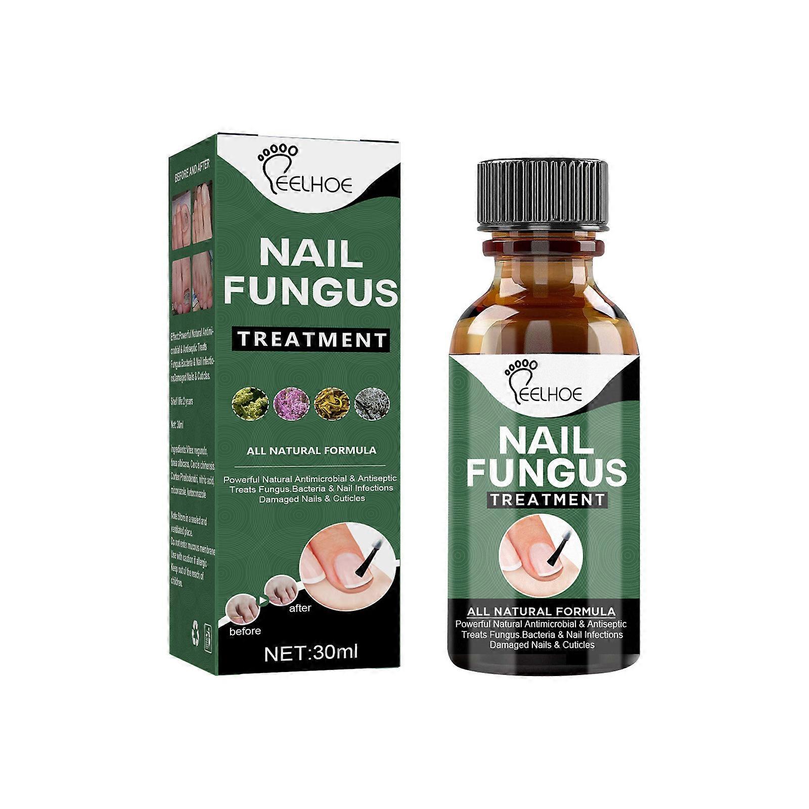Extra Strength Nail Repair Fluid Toenail And Nail Solution Toenails And Nails Repair Damaged And Discolored Nails