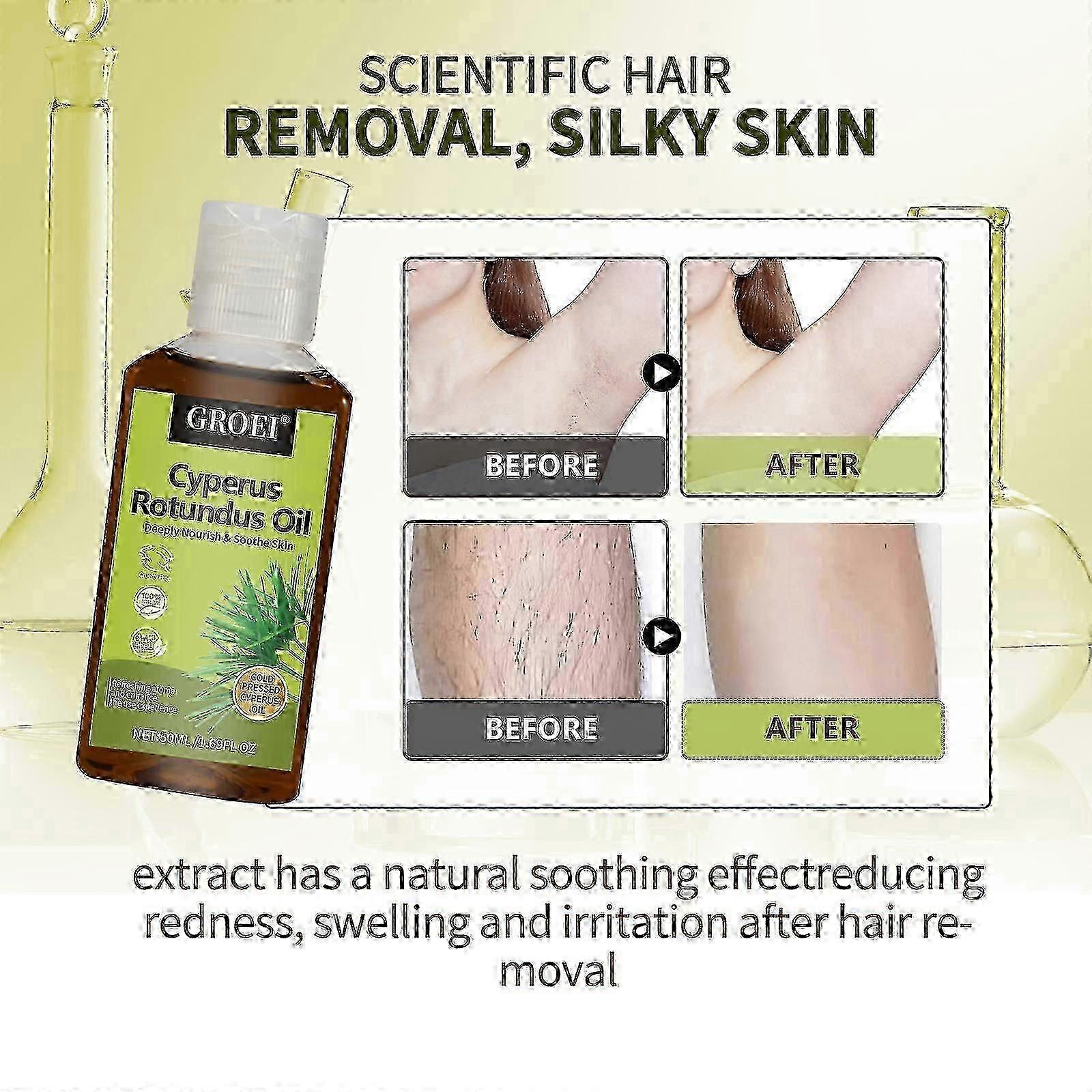 Cyperus oil Rotundus for hair removal - 100% natural Cyperus oil reducing the growth of body hair, moisturizing and soothing 50ml New Arrival 2025