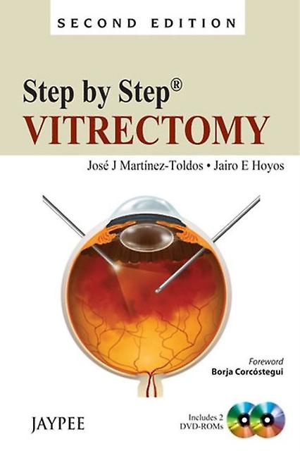 Step By Step Vitrectomy - Jose J Martinez-Toldos