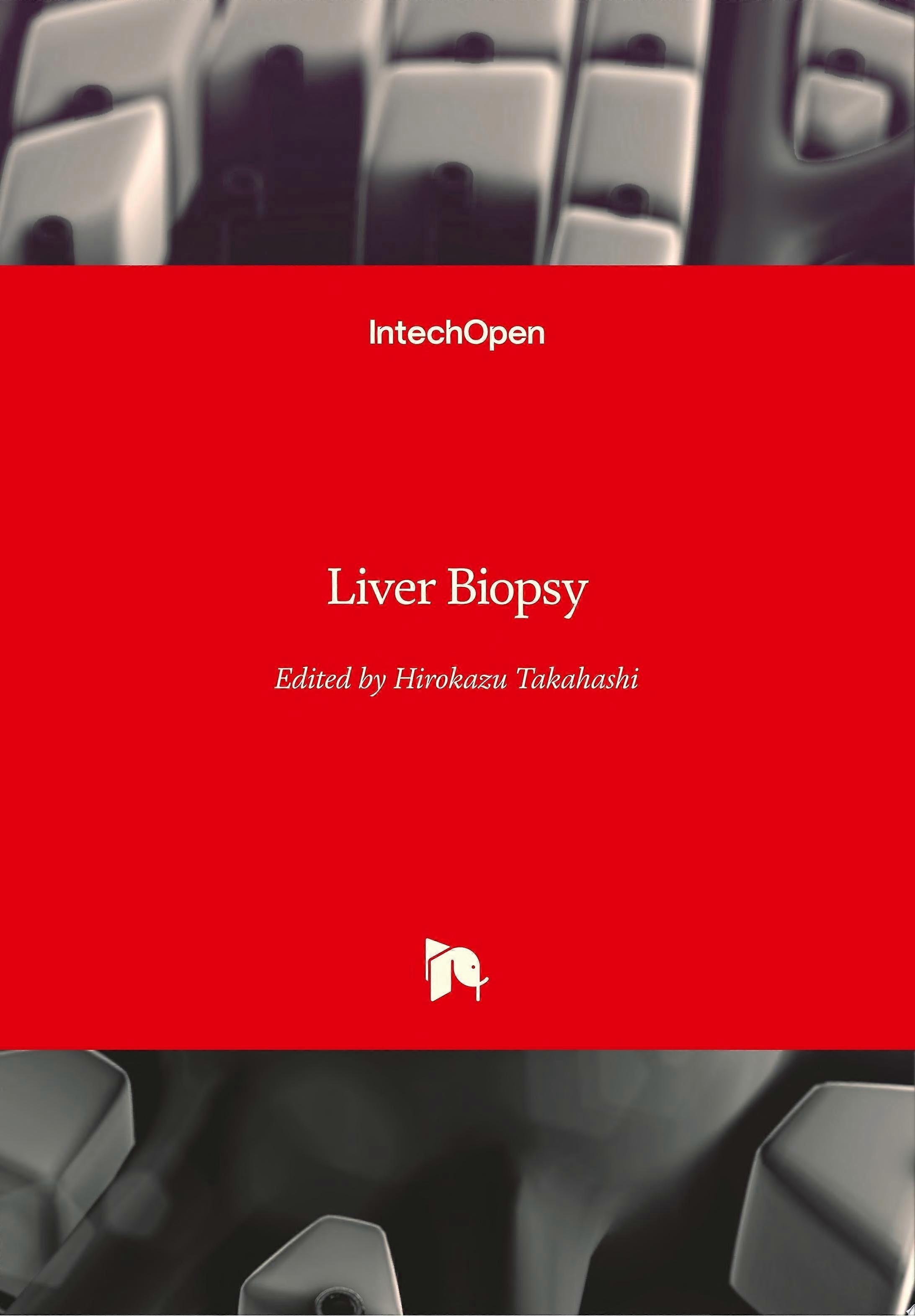 Liver biopsy