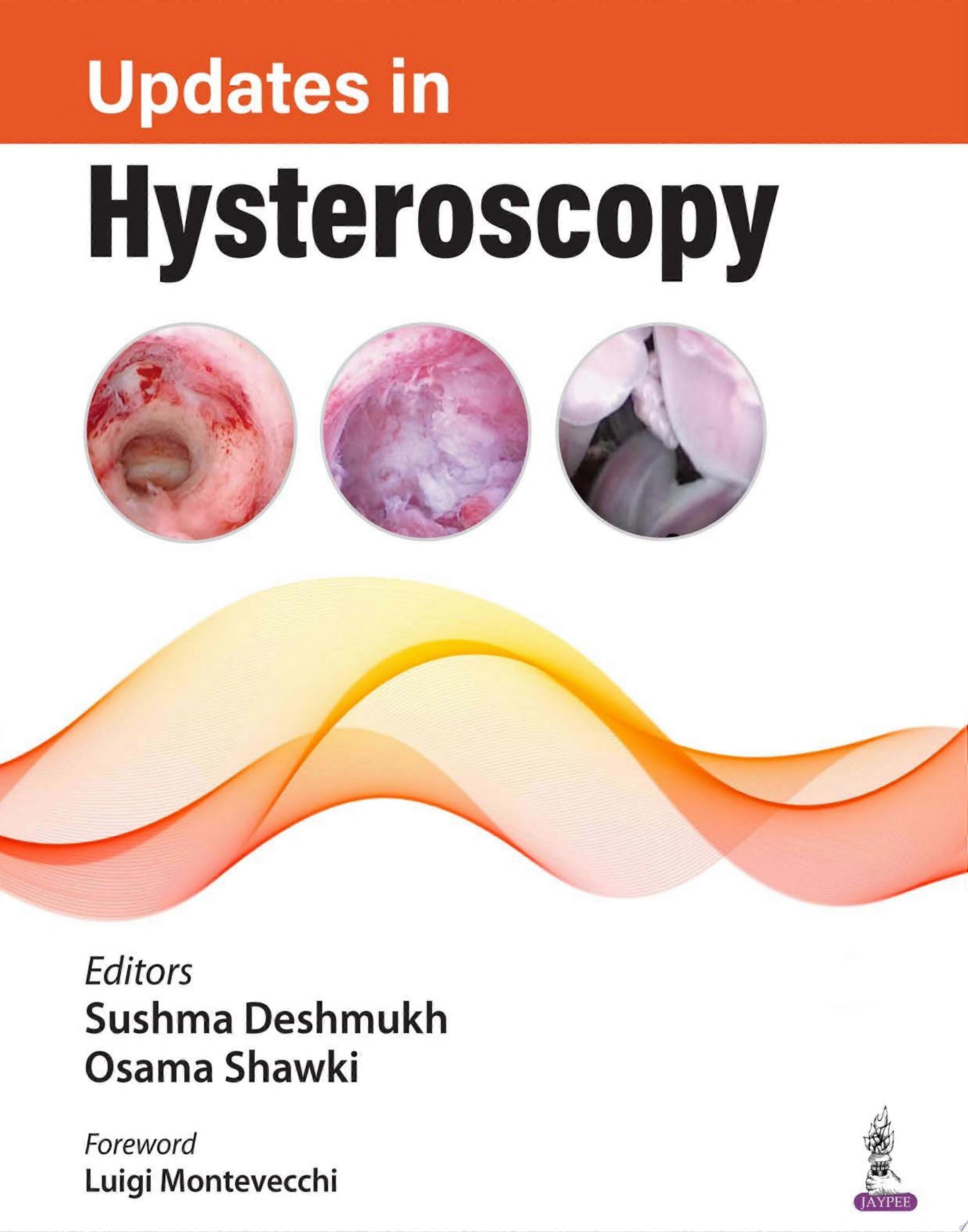 Updates in hysteroscopy
