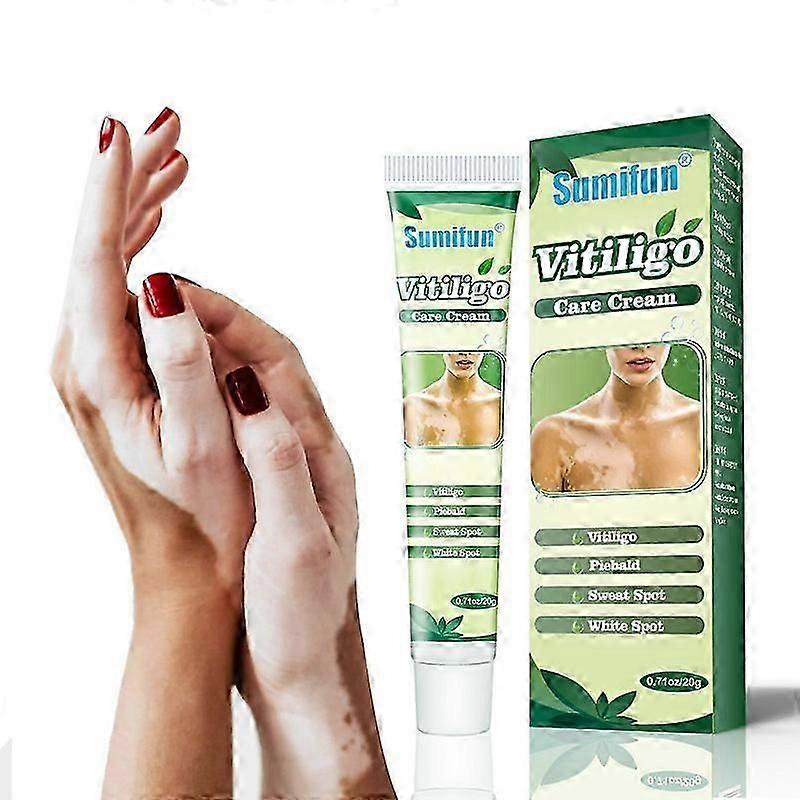 كريم البهاق، كريم علاج البهاق