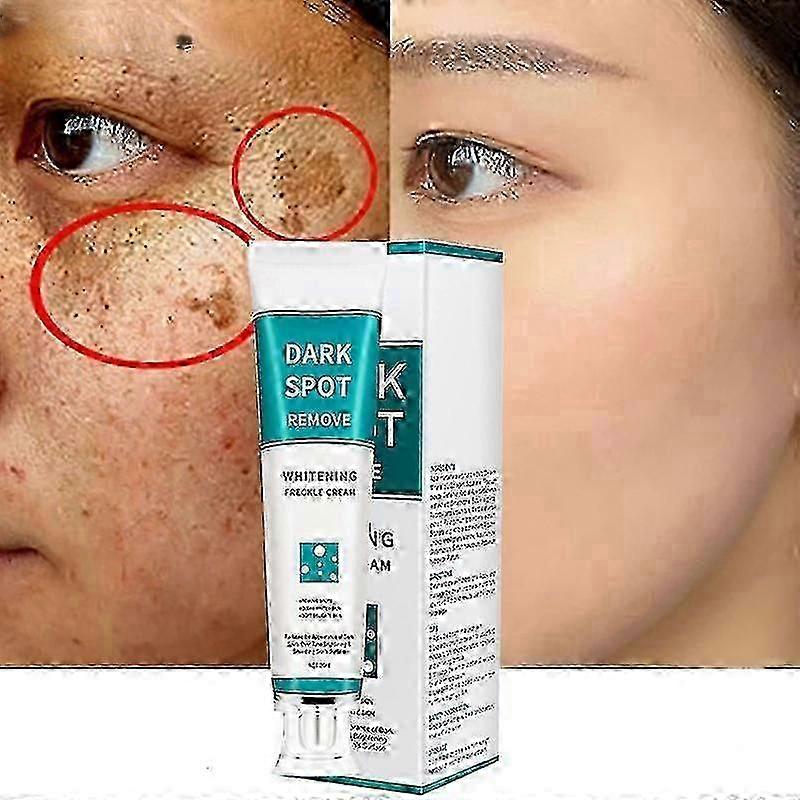 2025 Remover For Face, Corrector Cream, Cream Melasma Remover Fade Out Precipitate