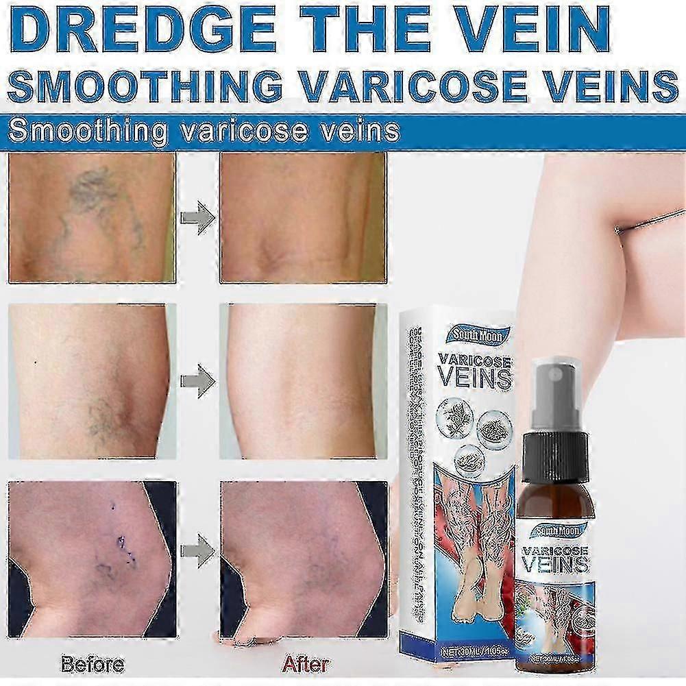 静脈瘤マッサージスプレーfo