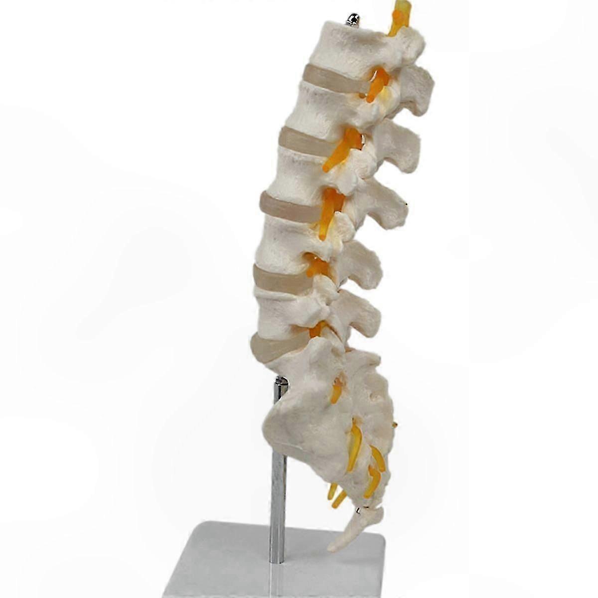 5-Segment Lumbar Spine Model with Sacral Attachment for Orthopedic Education and Demonstration Purposes