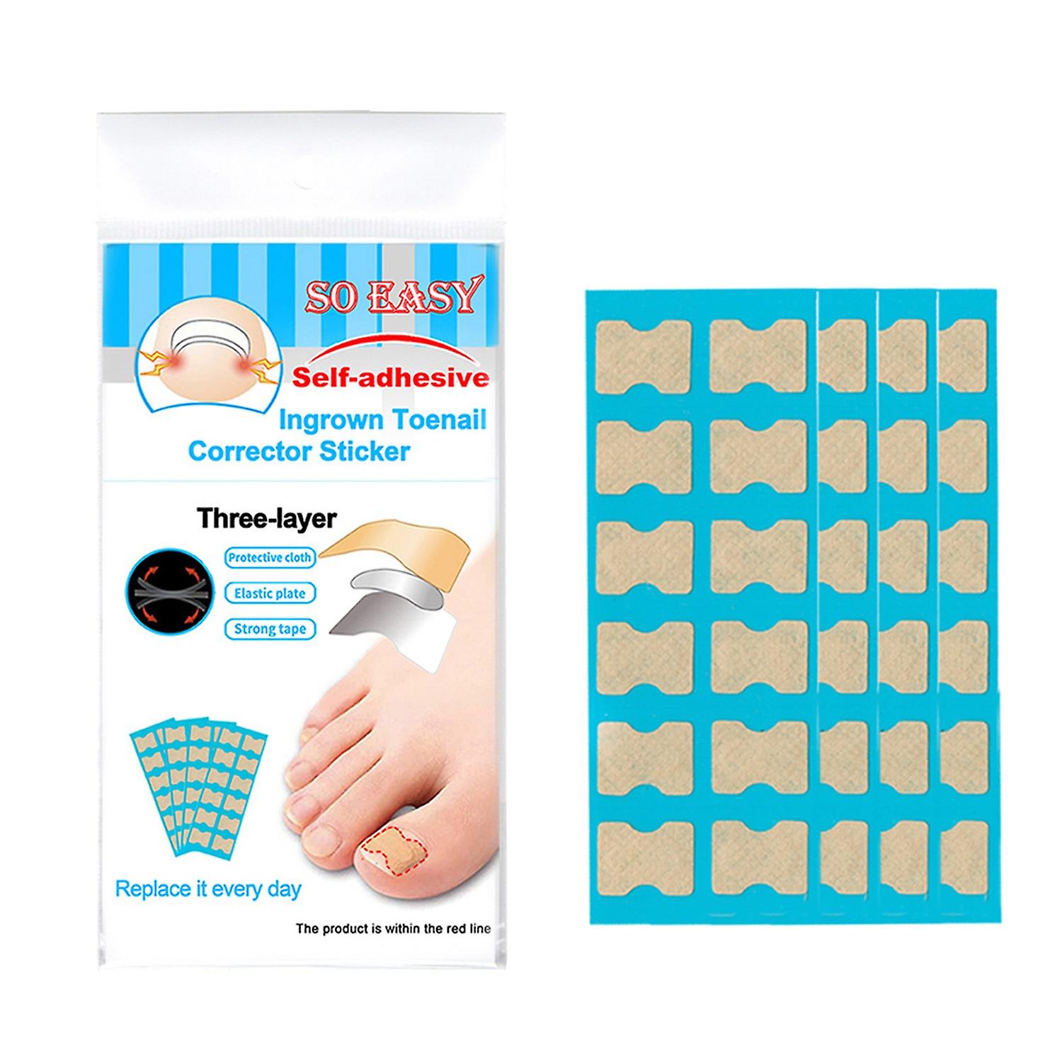 36Pcs Jelly Glue Self-adhesive Ingrown Teonail Corrector Stickers Simple Paste Daily Replacement Ing