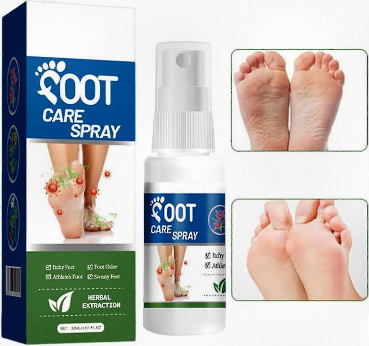 Foot Odor Neutralizing Spray, 30ml Deodorant for Athletes and Professionals, Effectively Banishes Unpleasant Shoe and Foot Smells