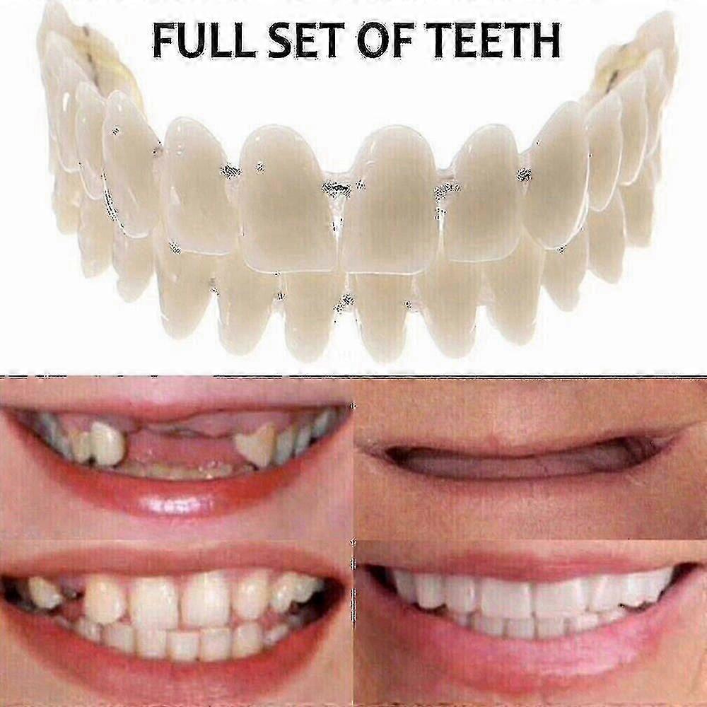 Dental Veneers Snap-On Set Upper Lower False Teeth Cover - YO