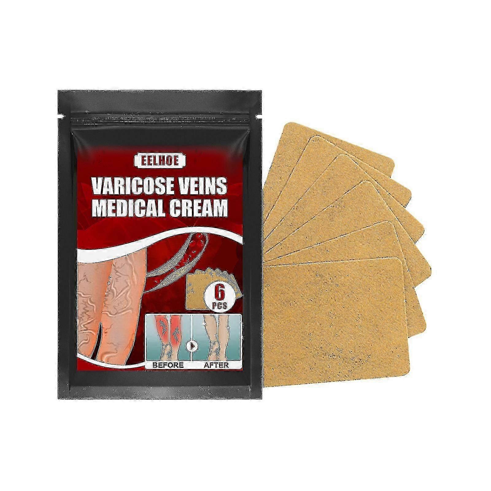 3pcs φλέβα μασάζ κιρσοί γύψο Patch πόδι πρήξιμο γαιοσκώληκες φλέβα ποδιών φλέβα μασάζ ανακούφιση πόνου έμπλαστρο