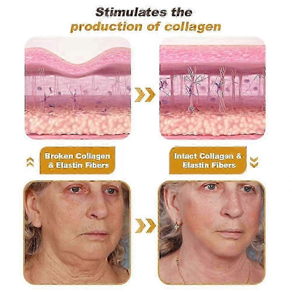 Nadaje się do 2/3/5 szt. kremu przeciwzmarszczkowego z jadem pszczelim do usuwania zmarszczek i przeciwstarzeniowego - jc