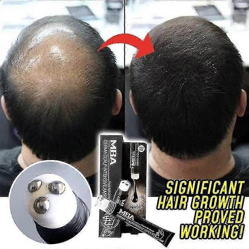 Cuoio capelluto Roll-on Hair Growth Serum Triple Roll Massager Regrow Hairline