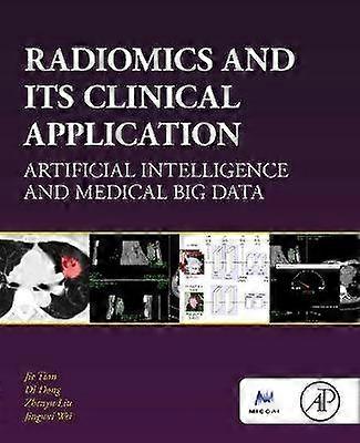 Radiomics and Its Clinical Application
