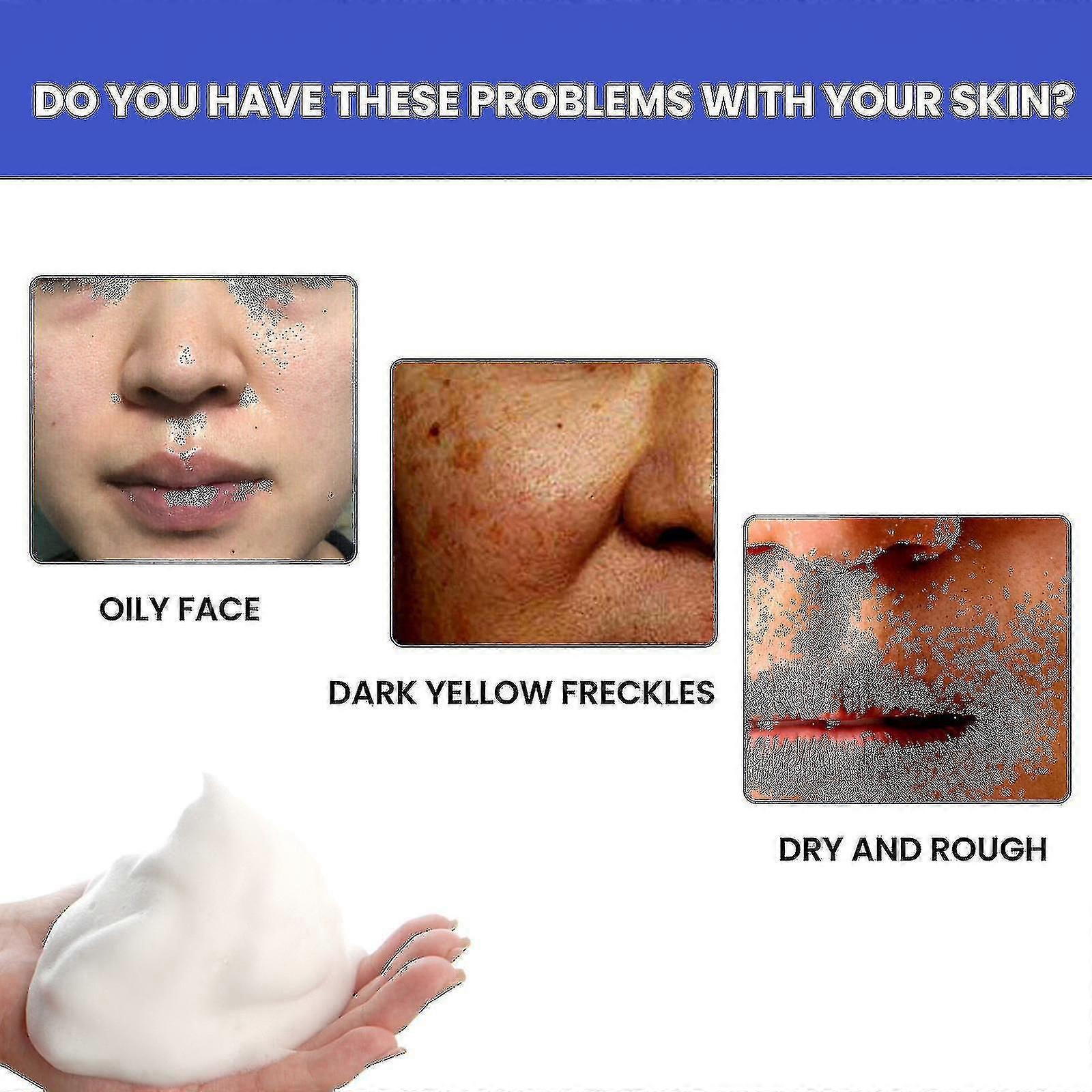 ナイアシンアミド洗顔料洗顔と水分補給ブライトニングスキンスポットライトニング発泡クレンザー50gボックス