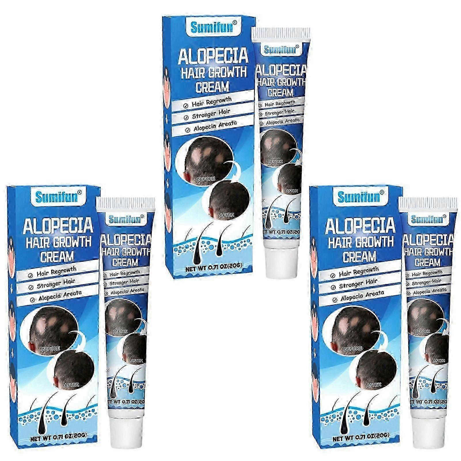 Extra Strength Alopecia Hair Growth Cream - Scalp Solution for Men and Women, Anti-Hair Loss