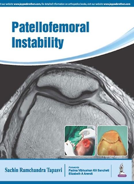 Patellofemoral Instability by Sachin Tapasvi Paperback Book