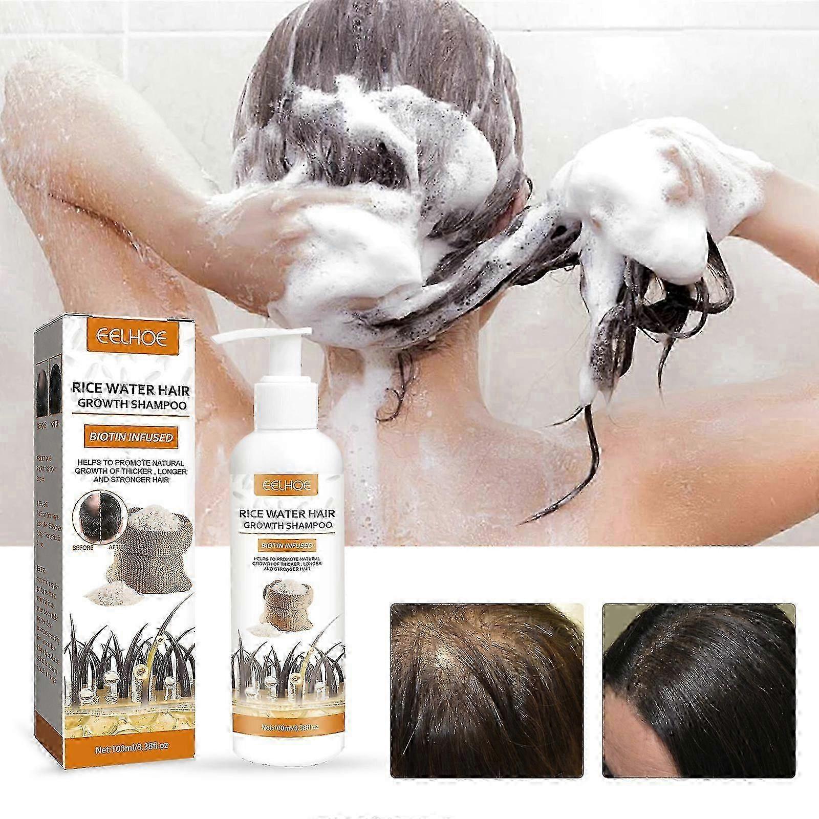 Optimized Hair Growth Shampoo with Biotin, Rice Water & Rosemary for Natural Thickening. Ideal for Thinning Hair & Hair Loss