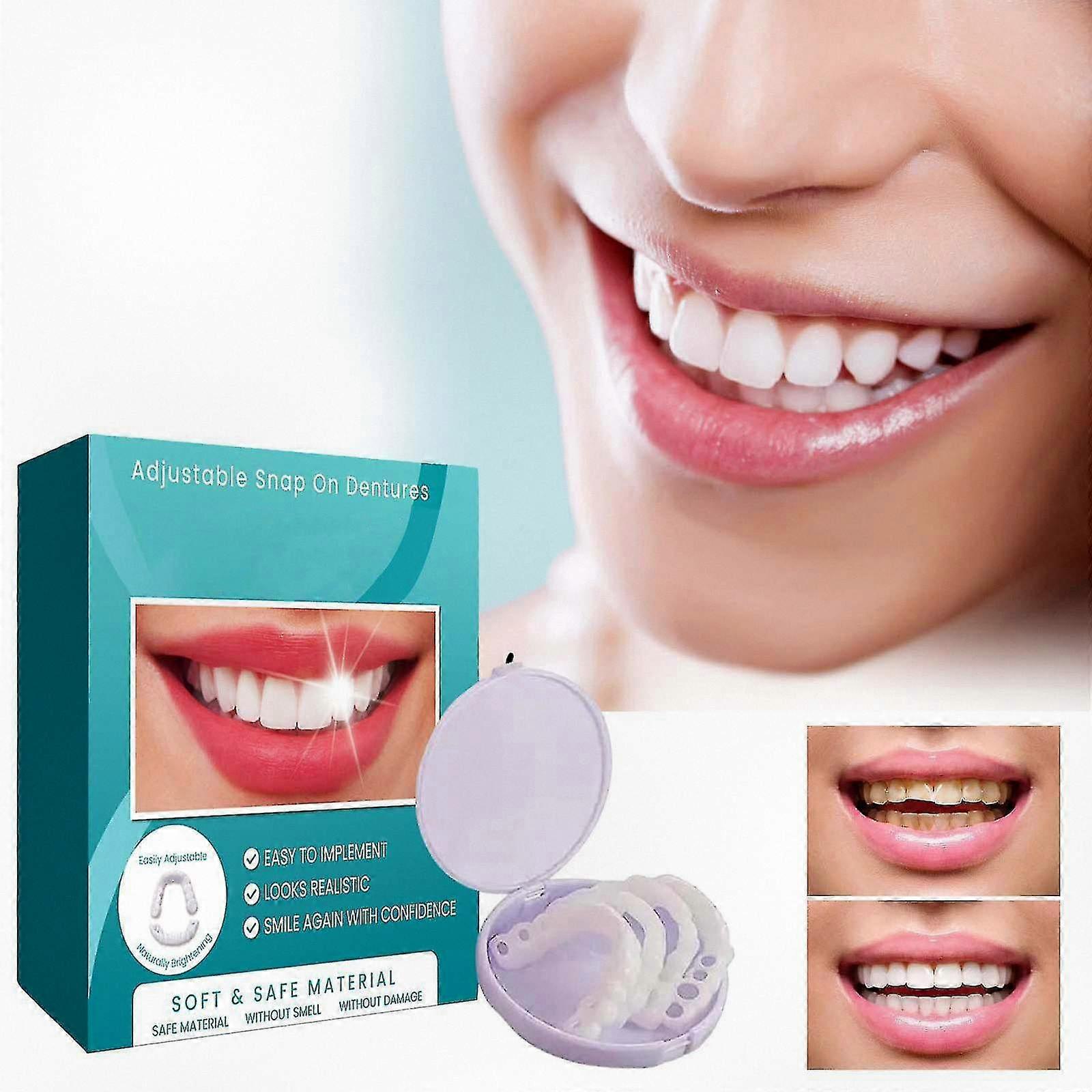Adjustable Snap-on Dental Veneers with Cases, Temporary Braces and Interdental Fillings for Teeth Alignment Kit