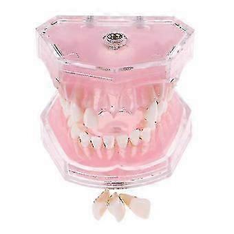 Dental Orthodontic Typodont Plastic Standard Model 4004 With 28 Removeable Teeth_