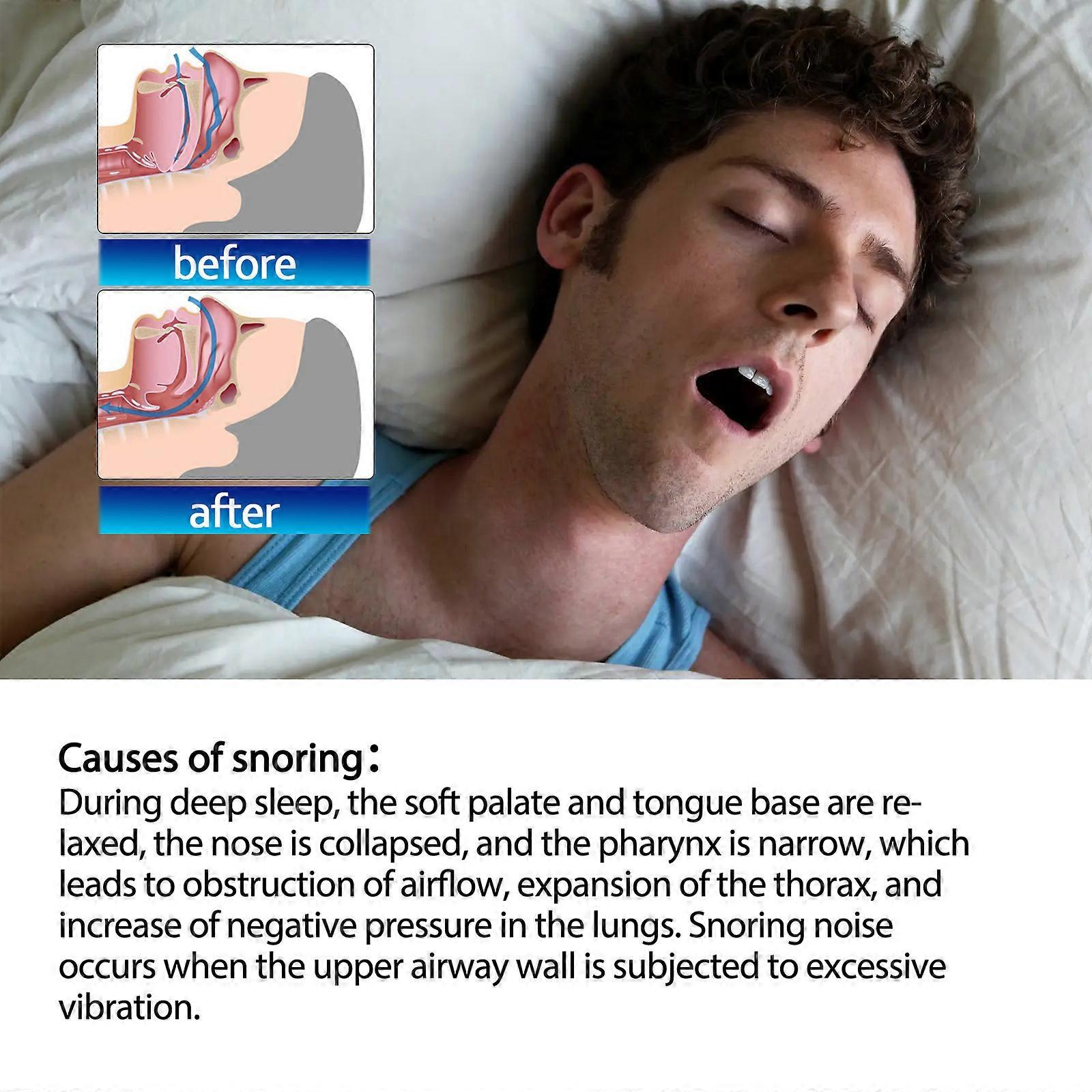 Anti-snoring patch sleeping ventilation nasal patch to prevent snoring, sleep talking, snoring, improve sleep care patch default item