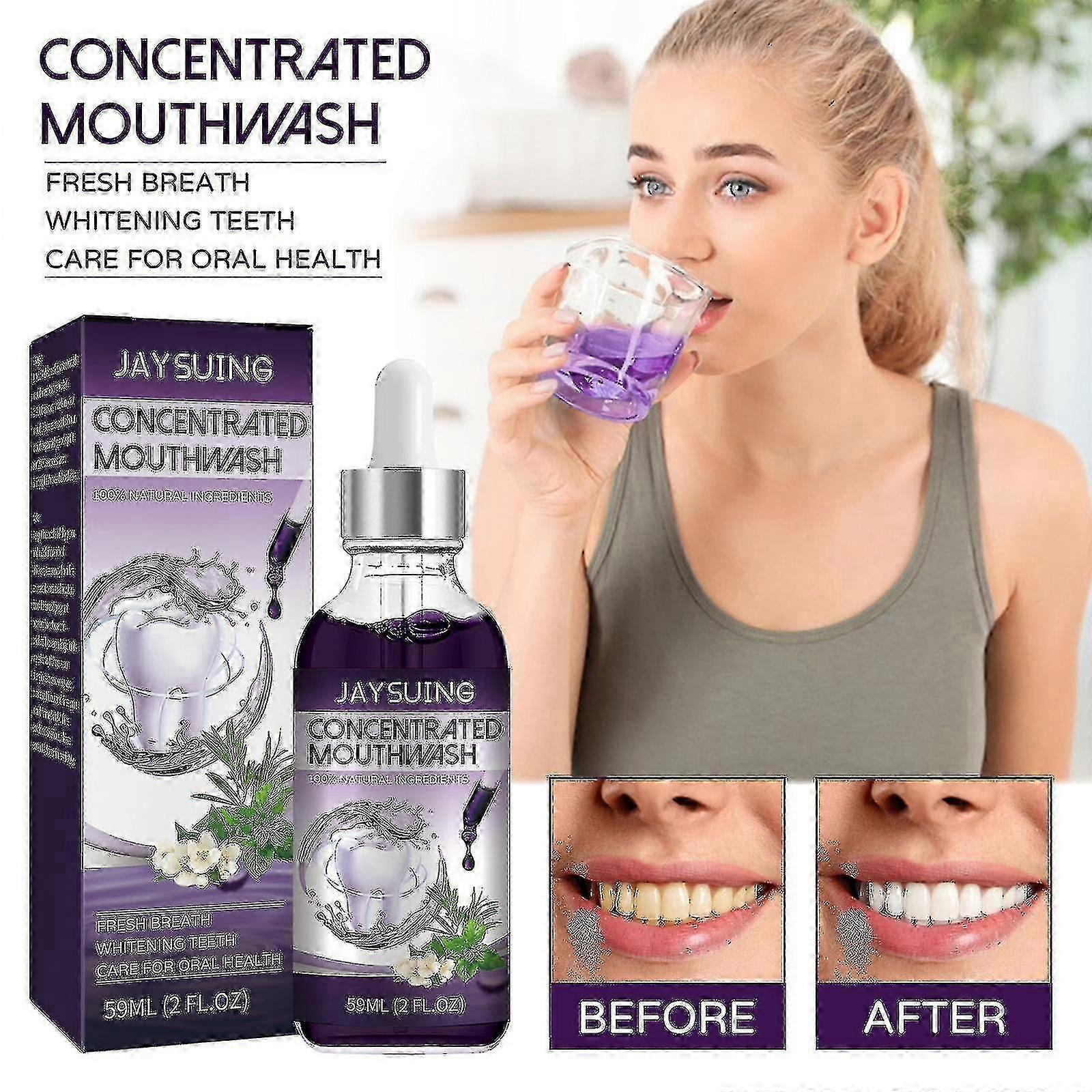 口臭、歯の汚れ、黄色の歯のクレンジング、新鮮な口、歯のホワイトニングマウスウォッシュBFのためのJaysuing濃縮うがい薬