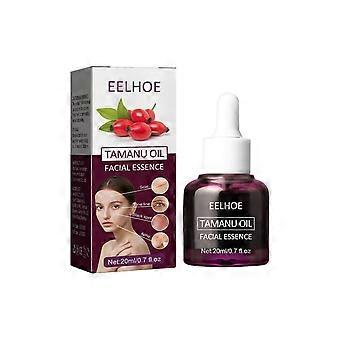 Tamanu Facial Oil, Relieves Acne Marks Fine Lines Moisturizes and Firms Skin Essential Oil