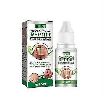 2024 New Essential Oil Nail Fungus Repair Liquid Nail Thickening Discoloration Off Soft Nail Thickening Type Onychomyc 20ml