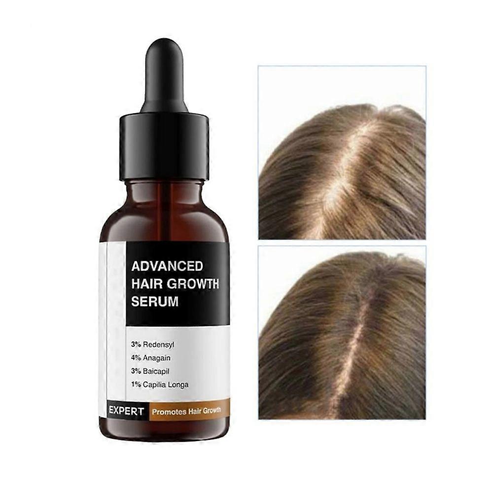 1-3 Stück Bare Anatomy Advanced Haarwuchsmittel - 30ml