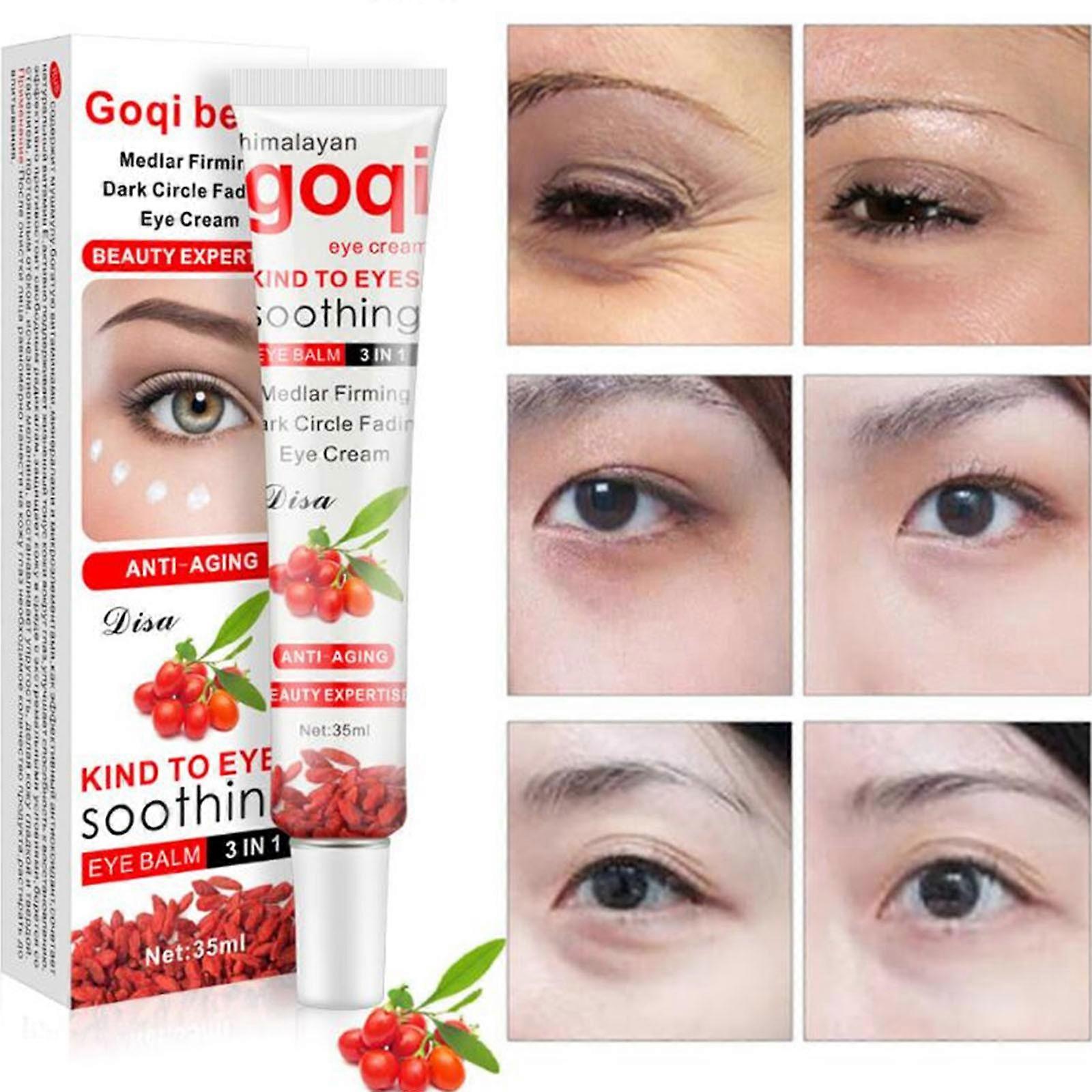 Goji Berry Multi-effect Eye Cream Fades Dark Circles Eye Cream Moisturizes And Moisturizes