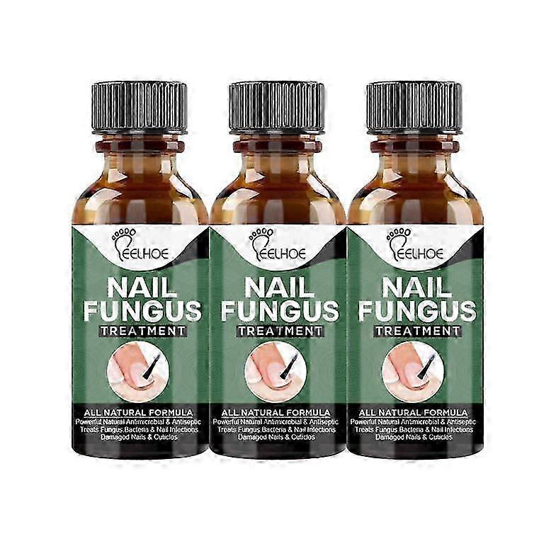 Extra silná léčba plísně nehtů, nejlepší oprava nehtů, zastavení růstu plísně, účinná 50 ml, 2025