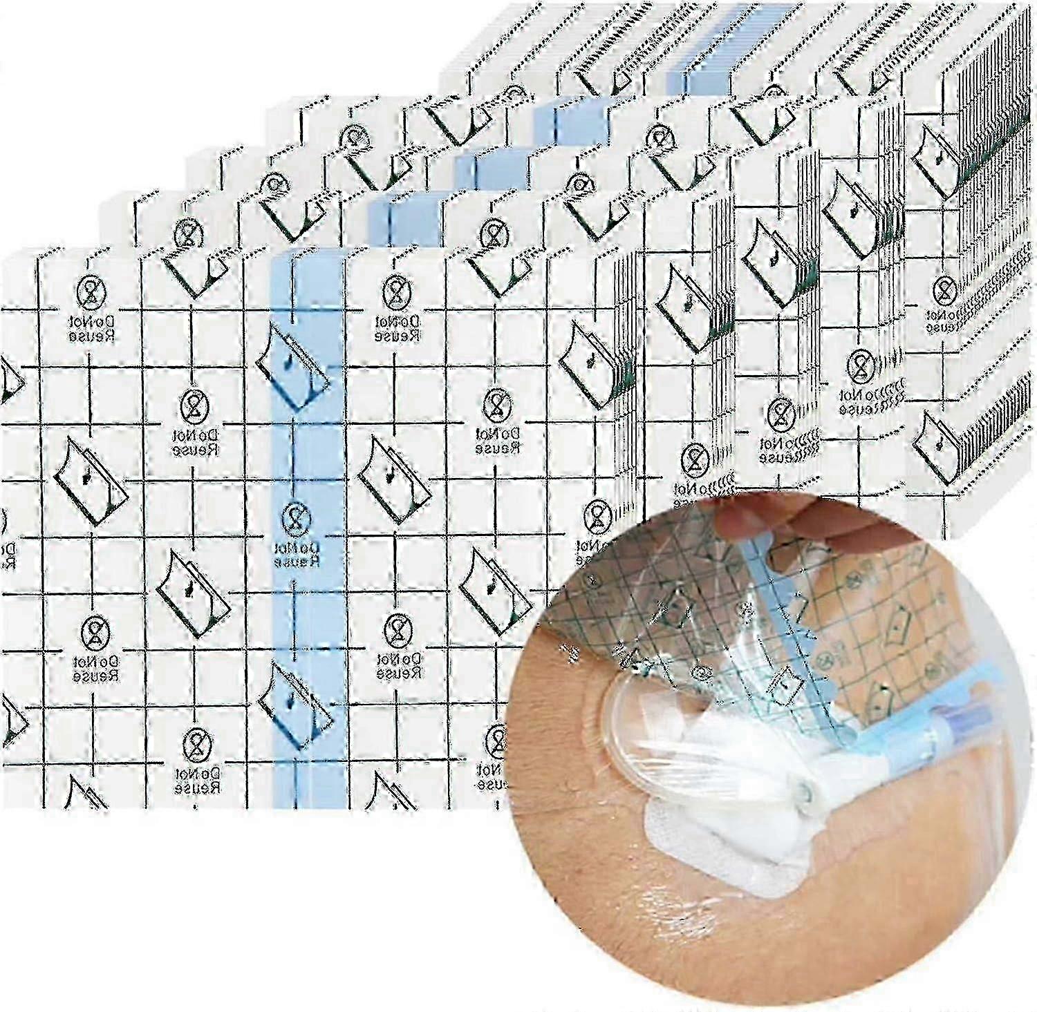 100 قطعة غطاء دش مقاوم للماء الدروع لغسيل الكلى ميناء بيك خط قسطرة الصدر Pd غسيل الكلى البريتوني المنفذ الكيميائي تغذية أنبوب G- أنبوب دش المريض