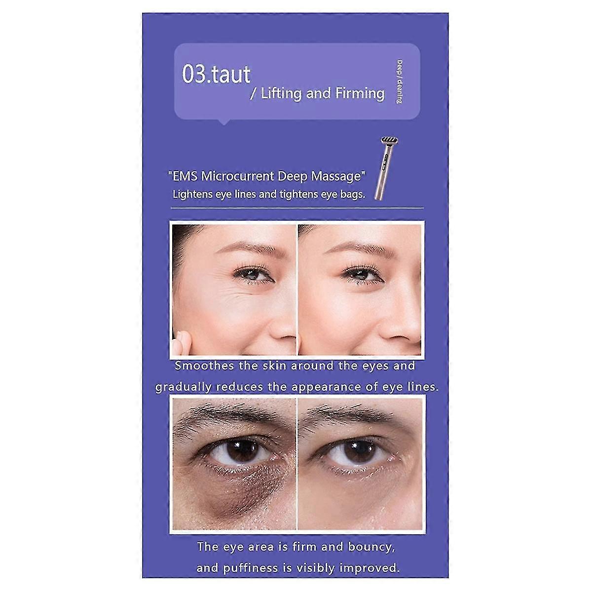 5 In 1 Facial Wand Microcurrent Device Anti-aging Red Blue Led Therapy Face Massager Rejuvenation Heat Therapy Tool(c)