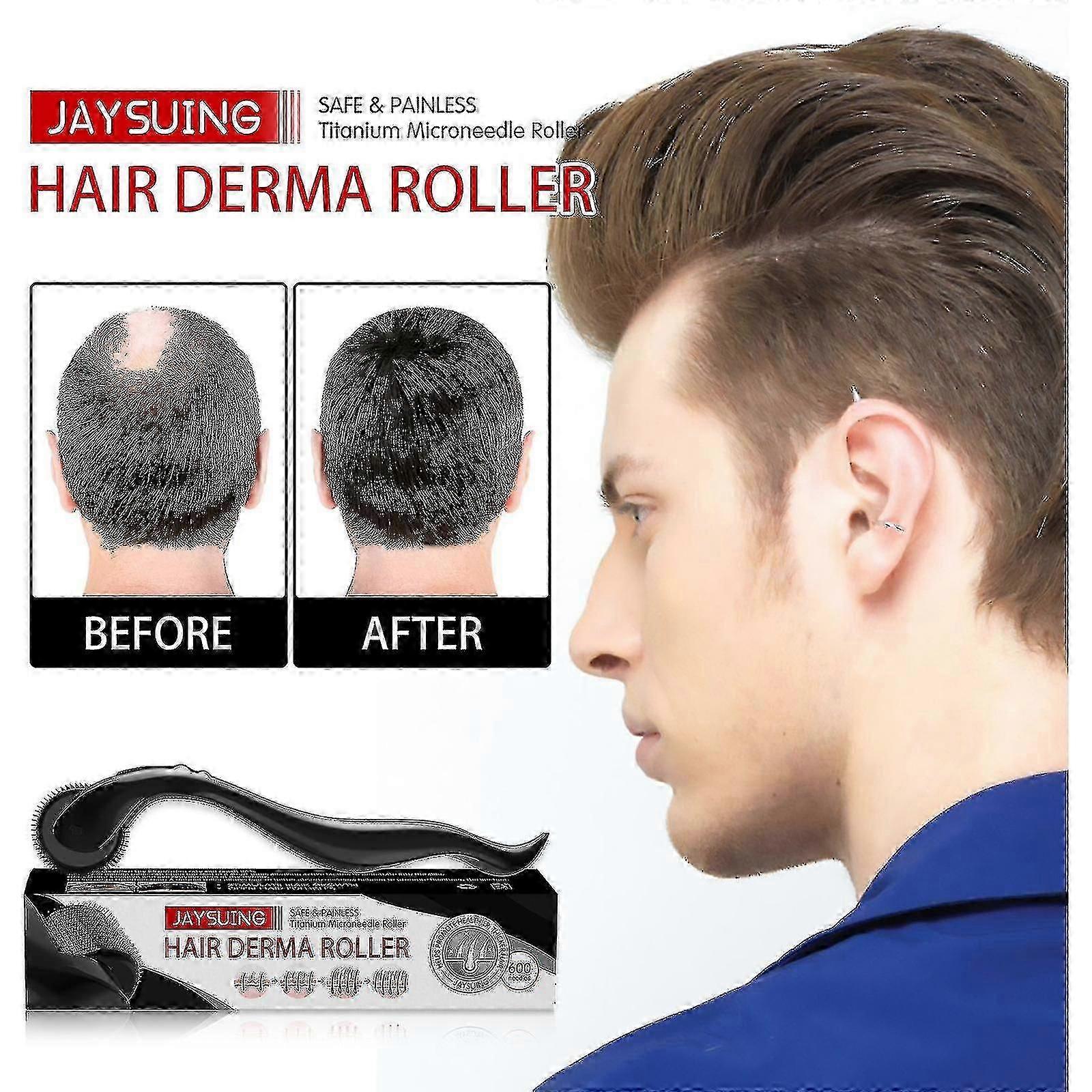 עיסוי שיער רולר עיסוי קרקפת מקדם עיסוי שיער רולר עבה מסרק שיער