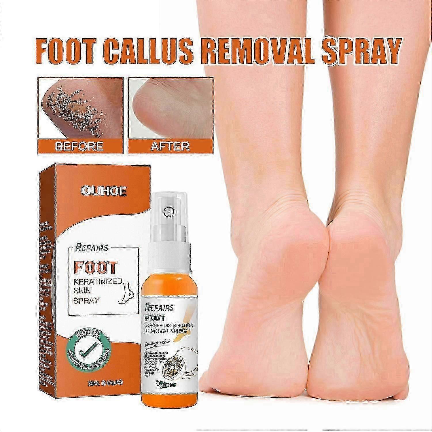 OUHOEフットエクスフォリエイティングスプレー、リペアヒールアンチクラッキングモイスチャライジングフットケアスプレー