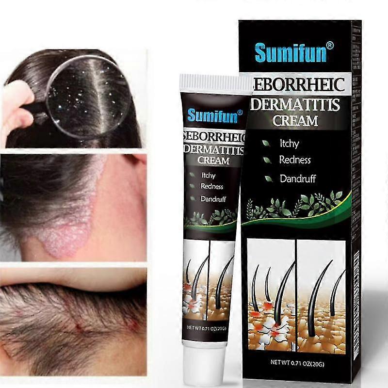 Θεραπεία της ψωριασικής σμηγματορροϊκής δερματίτιδας κρέμα κεφάλι ακμή κνησμός τριχωτό της κεφαλής τριχωτό της κεφαλής επισκευή τριχοφυτία κρέμα καθαρισμού δέρματος μαλλιά περιποίηση τριχωτού της κεφαλής