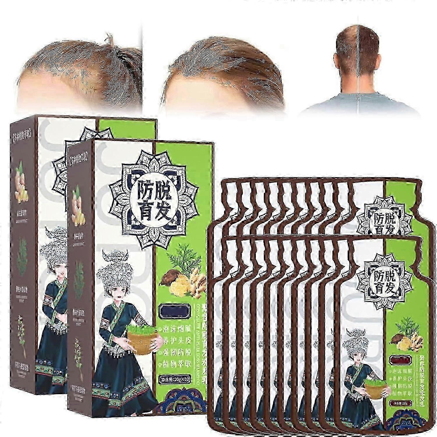 Ginger Extract Shampoo to Reduce Hair Loss and Promote Growth, Works for All Hair Types in UK