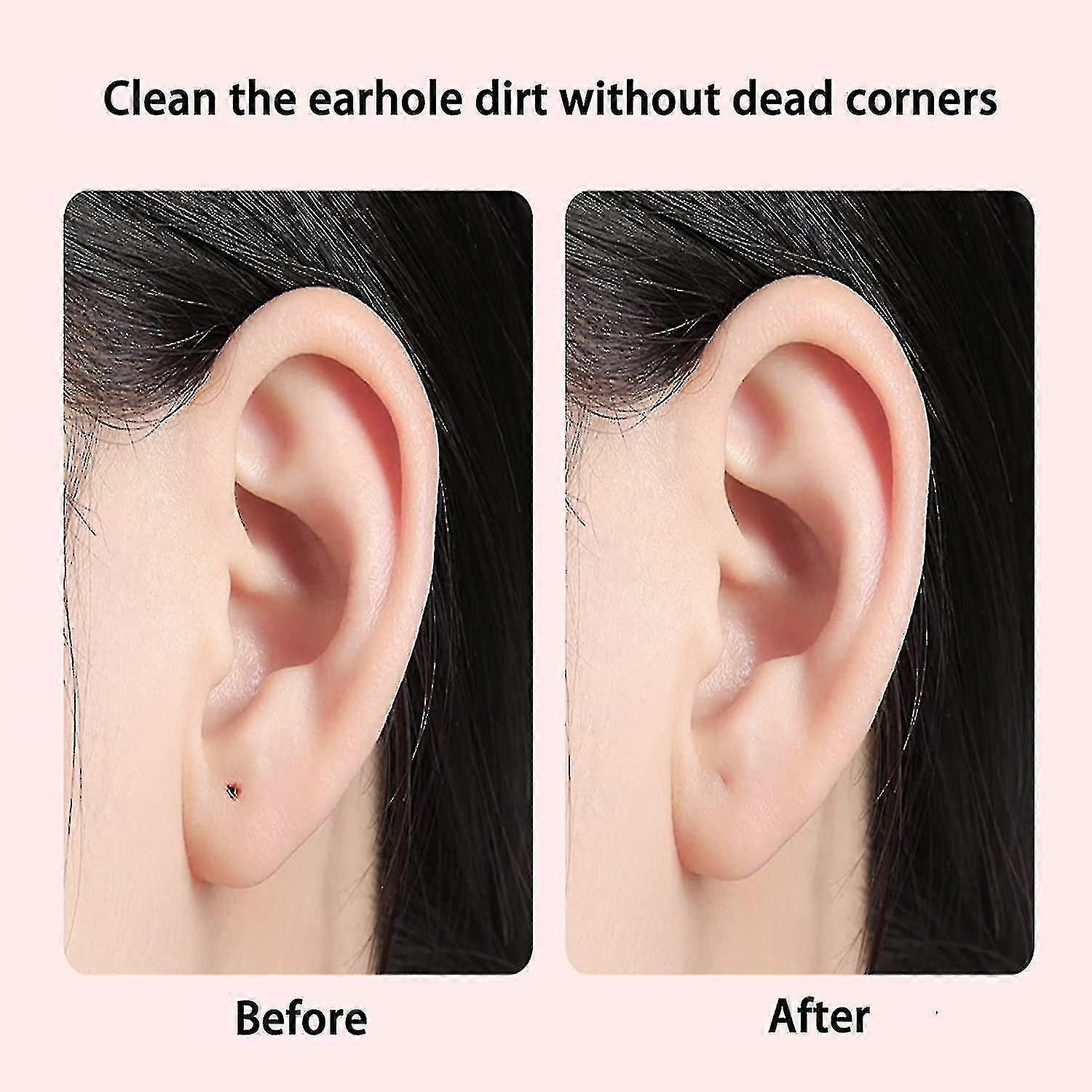 Reduce Ear How To Make Ear Piercing Hole Smaller Ear Stretching My