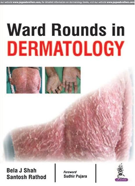 Ward Rounds In Dermatology by Santosh Rathod Paperback