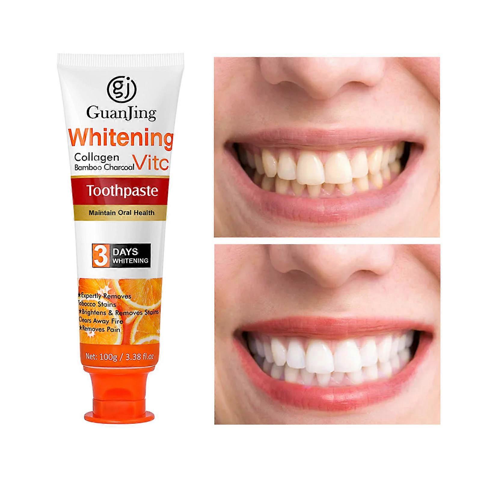 Toothpaste Improves Tooth Enamel And Tooth Sensitivity With Ingredients That Effectively Improve Tooth Sensitivity Flye2626