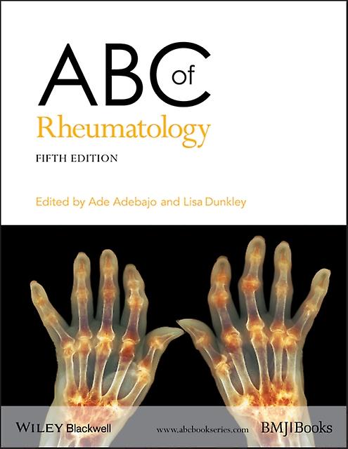 Abc Of Rheumatology Paperback Book